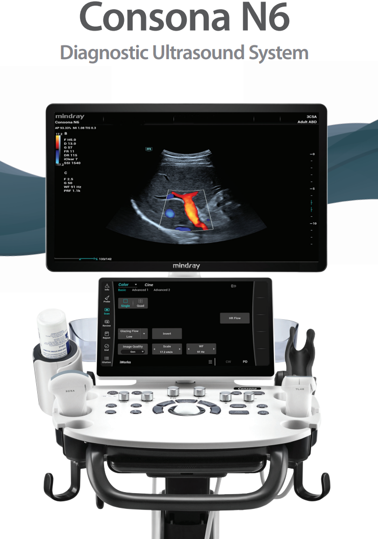 Mindray Consona N6 Main View