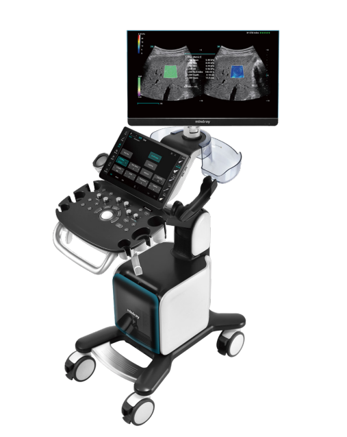 Mindray Consona N9 Main View