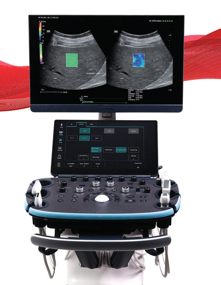 Mindray Resona I9 Main View